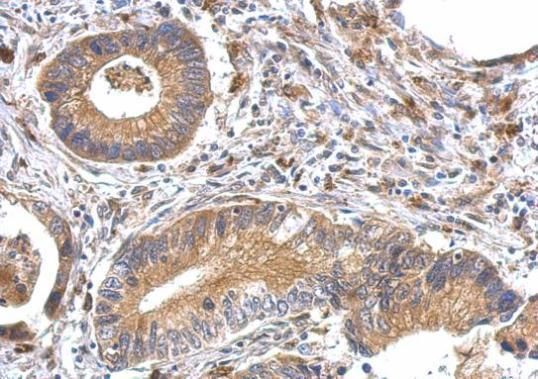 OFD1 Rabbit Polyclonal Antibody
