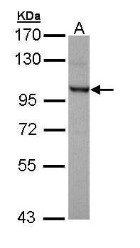 OFD1 Rabbit Polyclonal Antibody