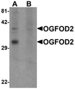 OGFOD2 Antibody