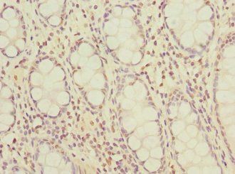 OGFR Antibody