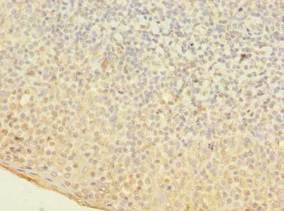 OGG1 Antibody