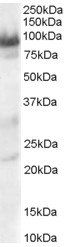 TRAK1 antibody