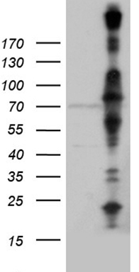 OIP5 antibody