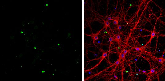 OLIG1 antibody [C2C3], C-term