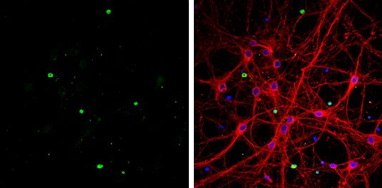 OLIG1 antibody