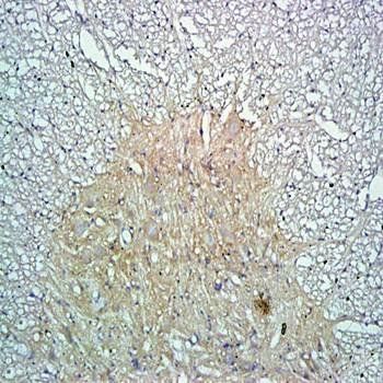 CLDN11 Rabbit Polyclonal Antibody