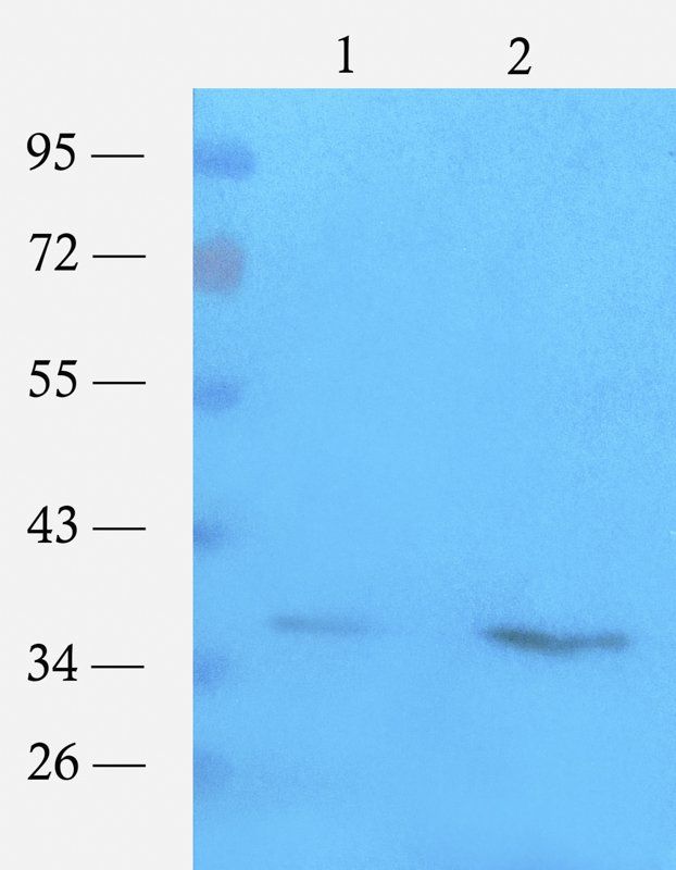 ompC antibody