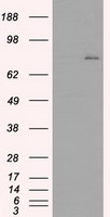 Oncostatin M (OSM) antibody