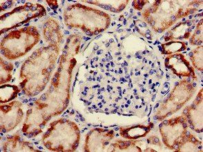 ONECUT2 Antibody