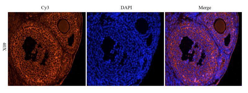 OPG Rabbit Polyclonal Antibody