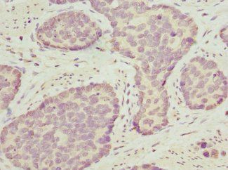 OPHN1 Antibody