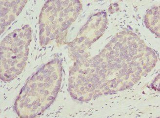OPHN1 Antibody