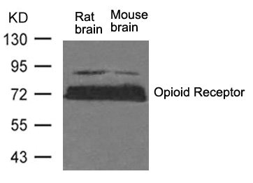 OPRM1 (Ab-375) Antibody