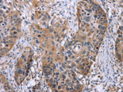 OPTN Antibody