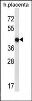 OR10V1 antibody