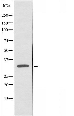 OR1B1 antibody