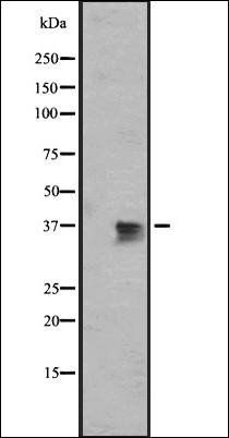 OR1J2/1N2 antibody