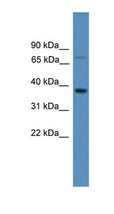 OR1S1 antibody