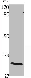 OR1S2 antibody