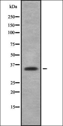 OR2A5/2A14 antibody