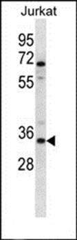 OR2G3 antibody