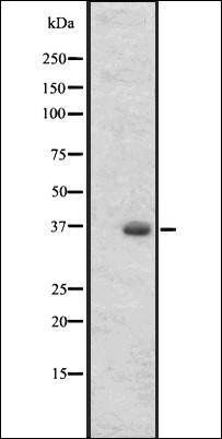 OR2T27 antibody