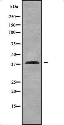 OR2T4 antibody