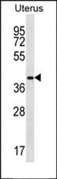 OR2V2 antibody