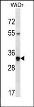 OR2W5 antibody
