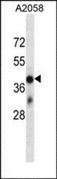 OR4D6 antibody