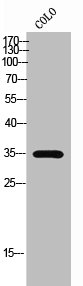 OR51A7 antibody