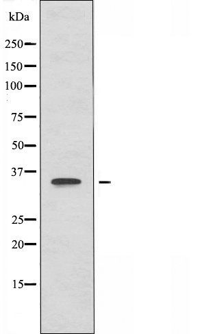 OR51B5 antibody