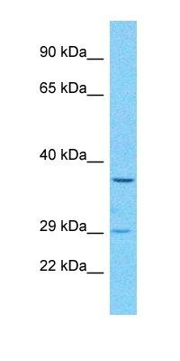 OR52B6 antibody