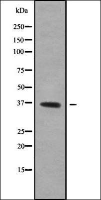 OR52E6/52E8 antibody