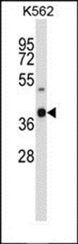 OR52H1 antibody