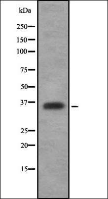 OR52N2 antibody