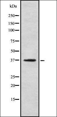 OR5R1 antibody
