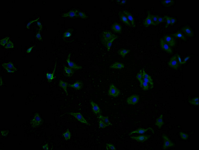 OR5T2 antibody