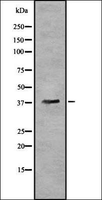 OR5T3 antibody
