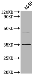 OR5V1 antibody