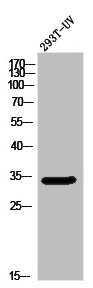 OR5W2 antibody