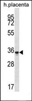 OR6K6 antibody
