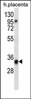 OR6N2 antibody