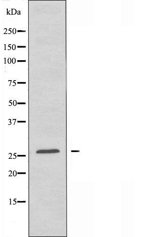 OR7E5P antibody