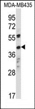 OR8K1 antibody
