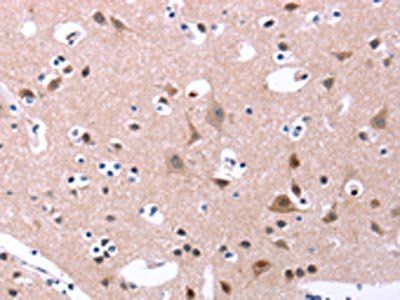 ORAI1 Antibody