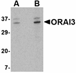 ORAI3 Antibody