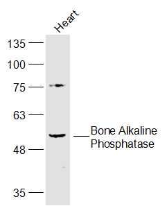 Bone Alkaline Phosphatase antibody