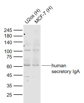 Human secretory IgA antibody