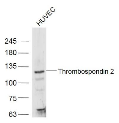 Thrombospondin 2 antibody